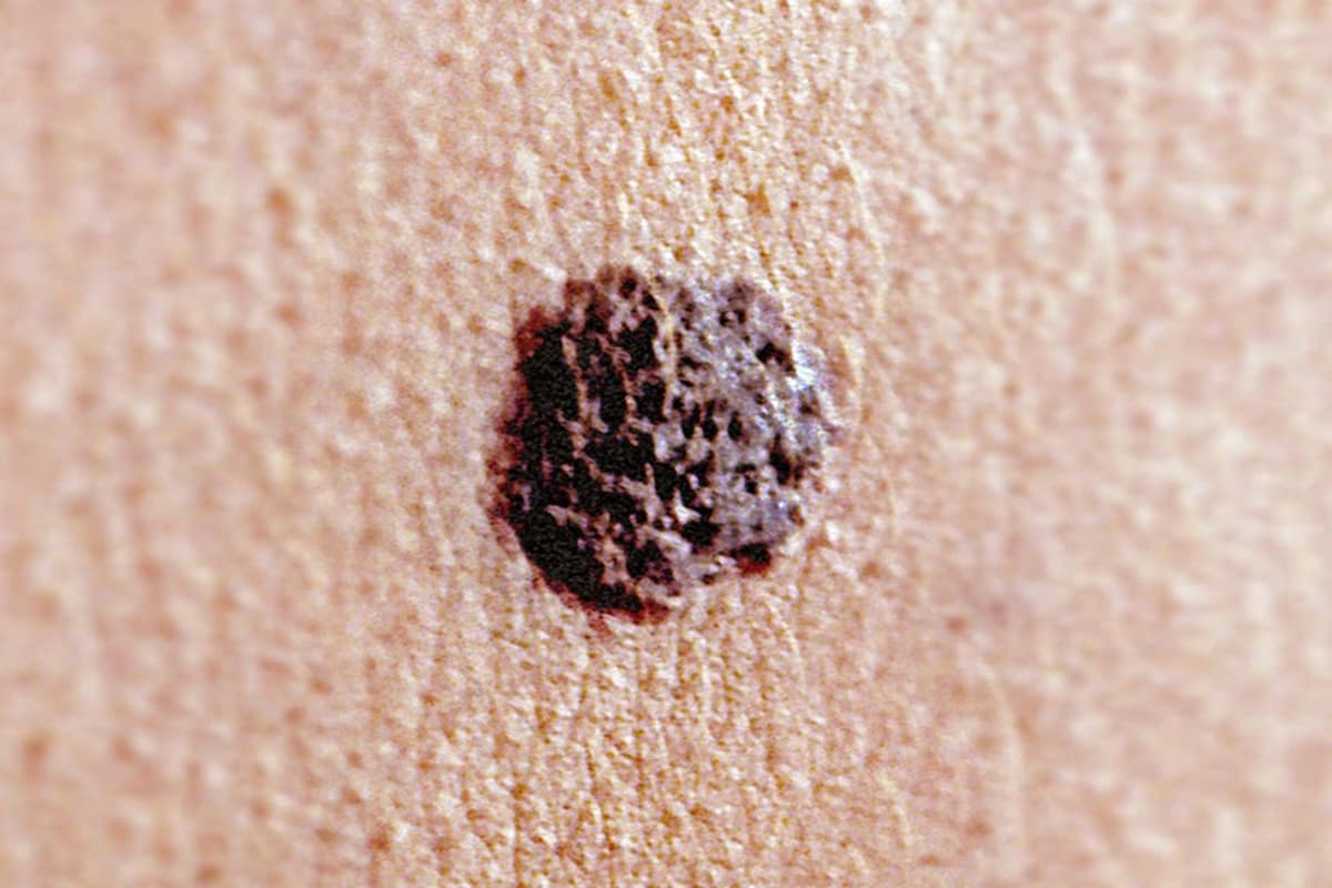 New Study Shows How mRNA Vaccines Could Transform Cancer Treatment