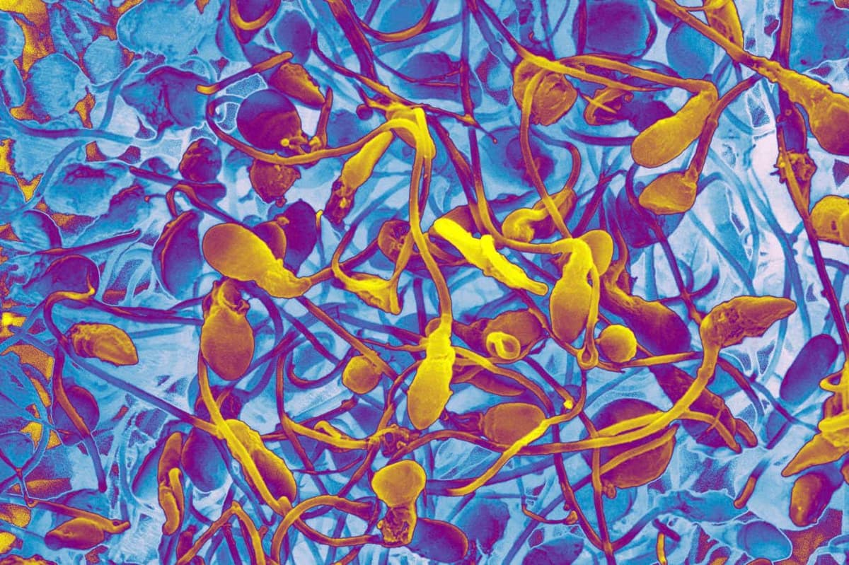 Will Lab-Grown Sperm Let Infertile Men Have Children of Their Own?
