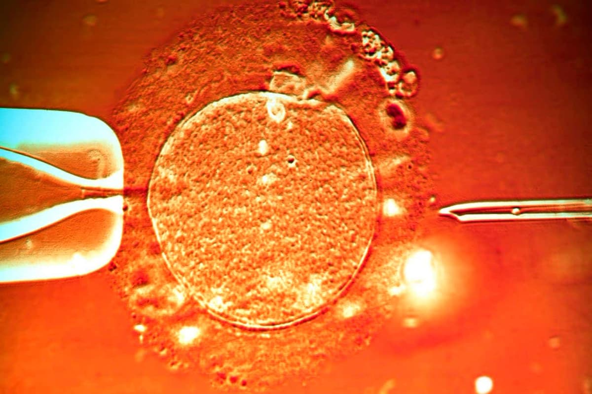 Sperm Have Been Made Magnetic to Allow IVF Inside the Body