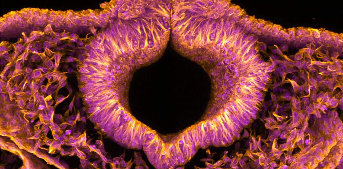 Fluorescent Quail Embryos Could Help Solve Serious Birth Defects in Humans