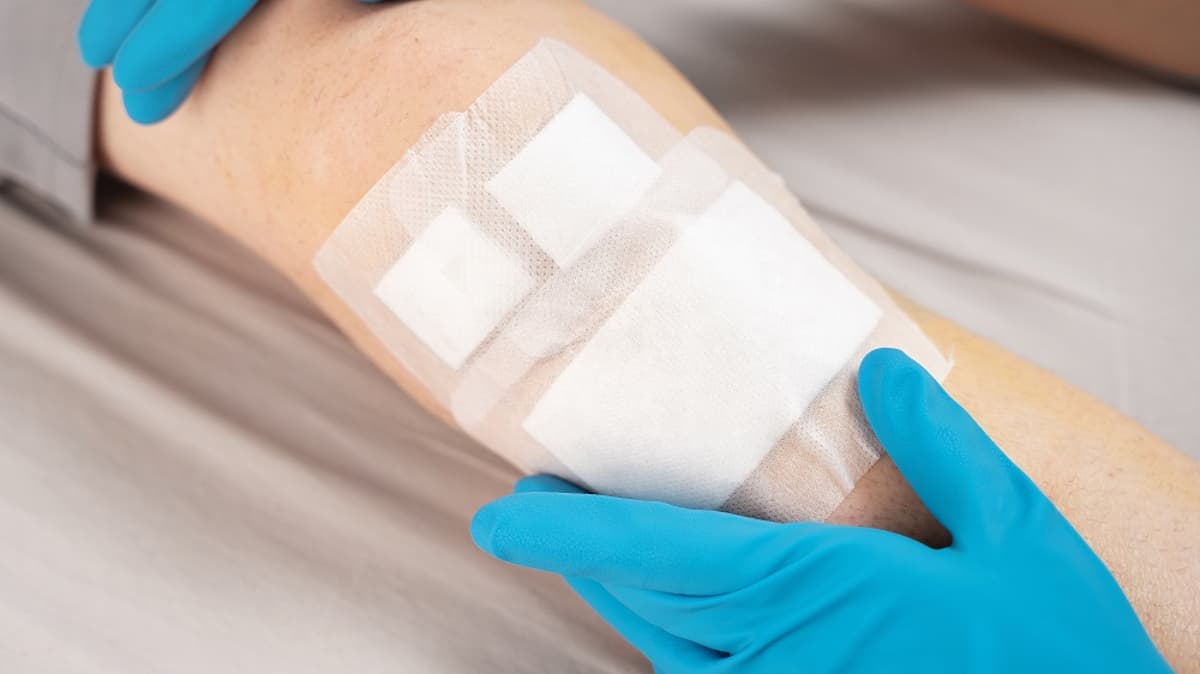 A Robust Senescence Response Helps Wounds Heal