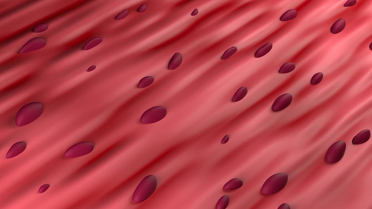How Antioxidants Can Selectively Remove Some Senescent Cells