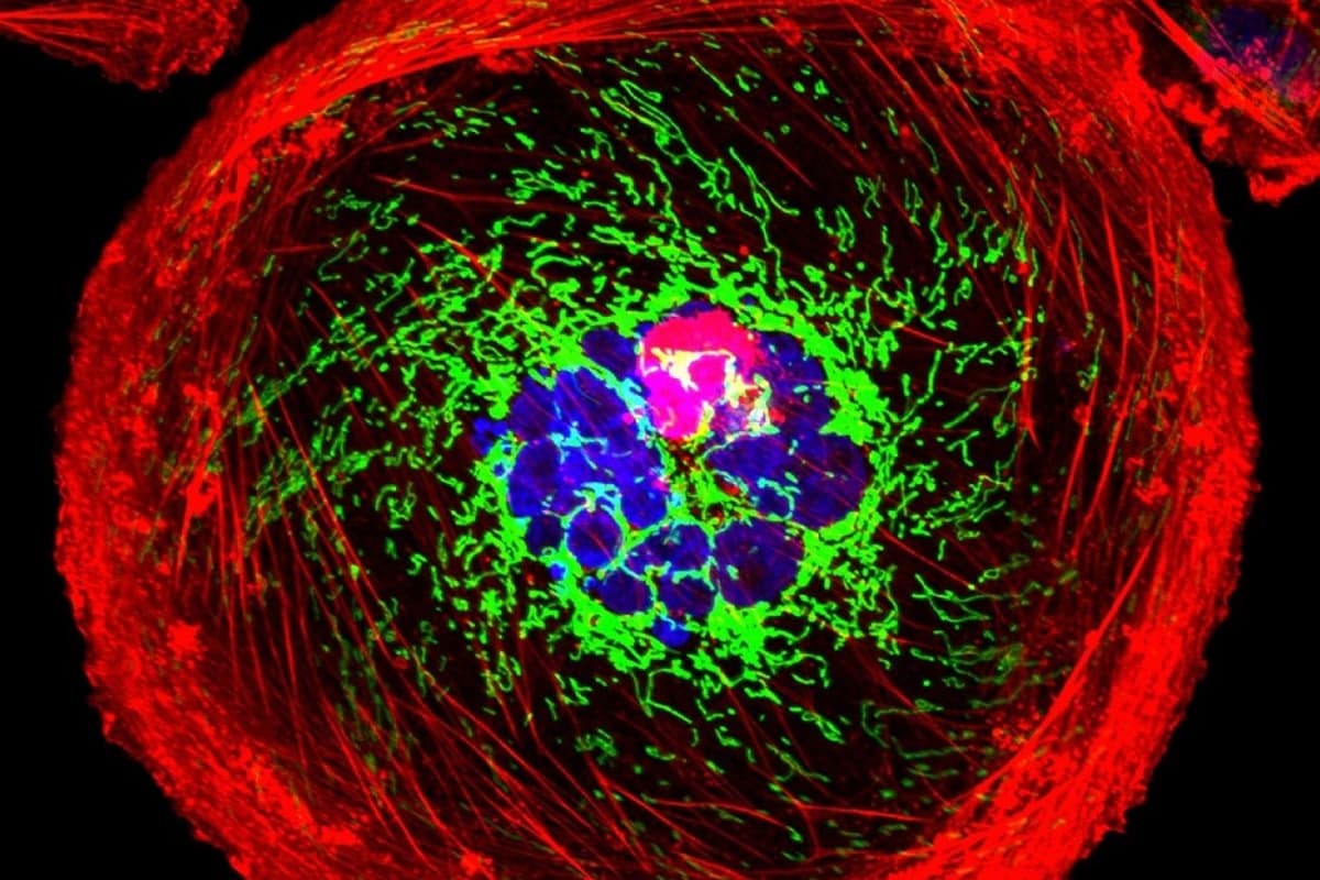AstraZeneca, Daiichi Drug Approved as New First-Line Therapy for Tough Type of Breast Cancer