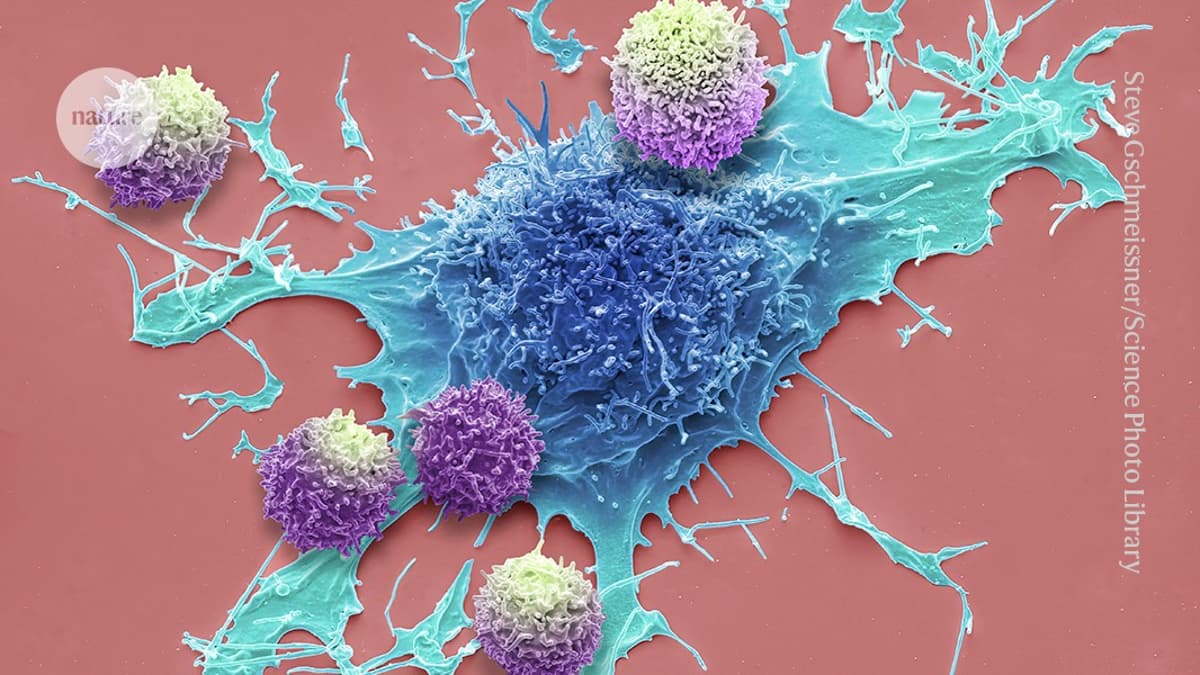 Long-Lived Immune Cells Show Promise Against Cancer in World-First Trial
