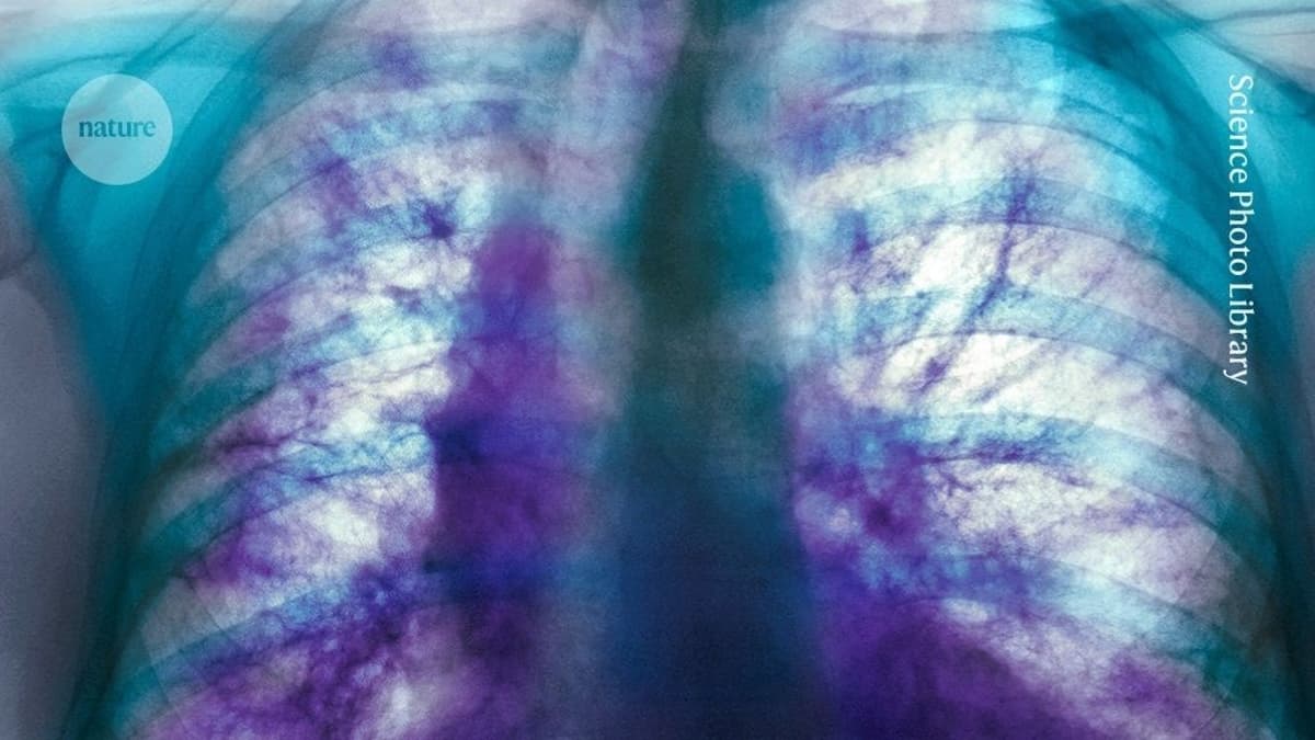 This Mysterious Lung Disease Affects Millions of People — but a Drug Tested in Mice Shows Promise