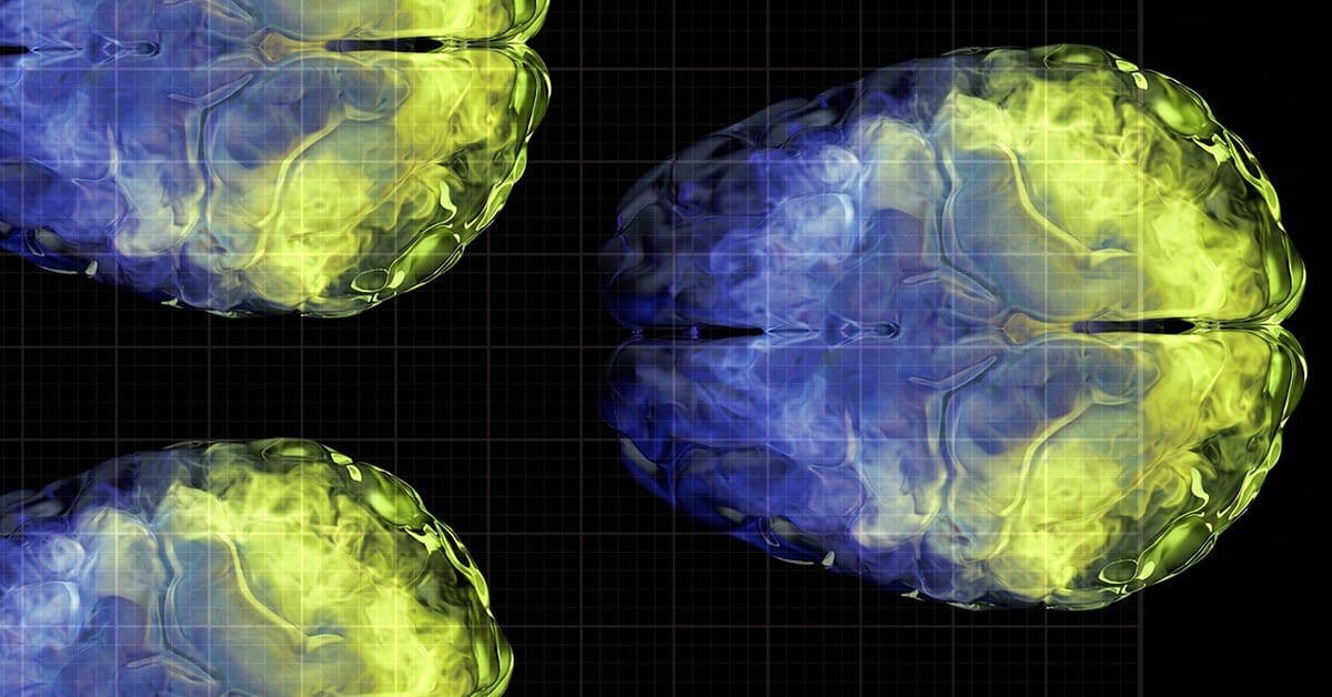 Vitamin C May Help Preserve Brain Gray Matter Volume as We Age