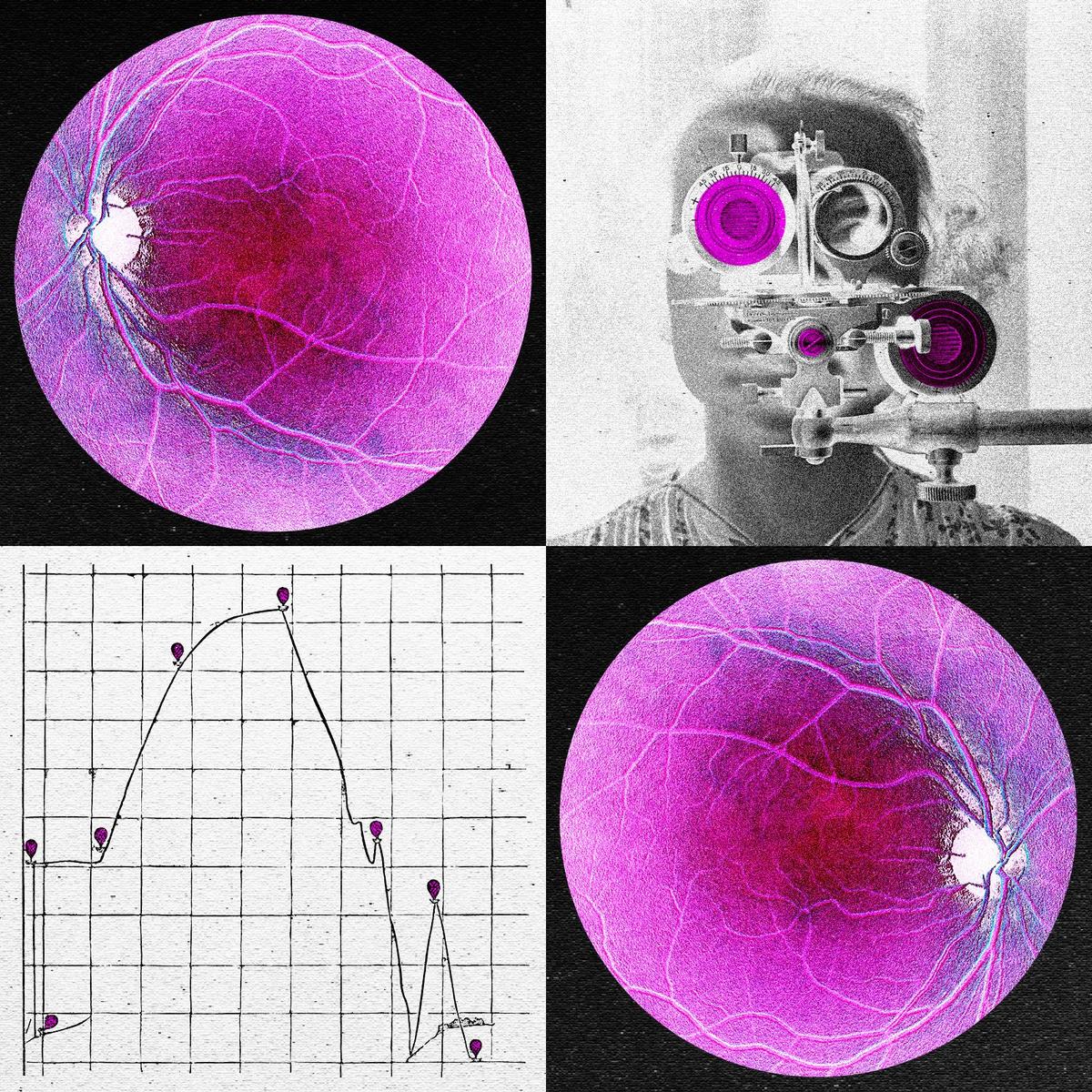 Longevity Startup Doses First Human in Bid to Reverse Age-Related Sight Loss