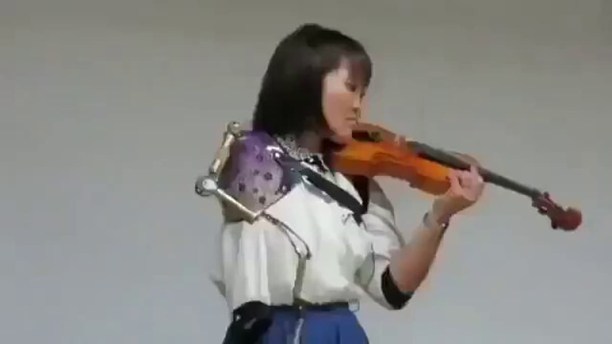 Robotic Arm Lets Amputee Violinist Play Again
