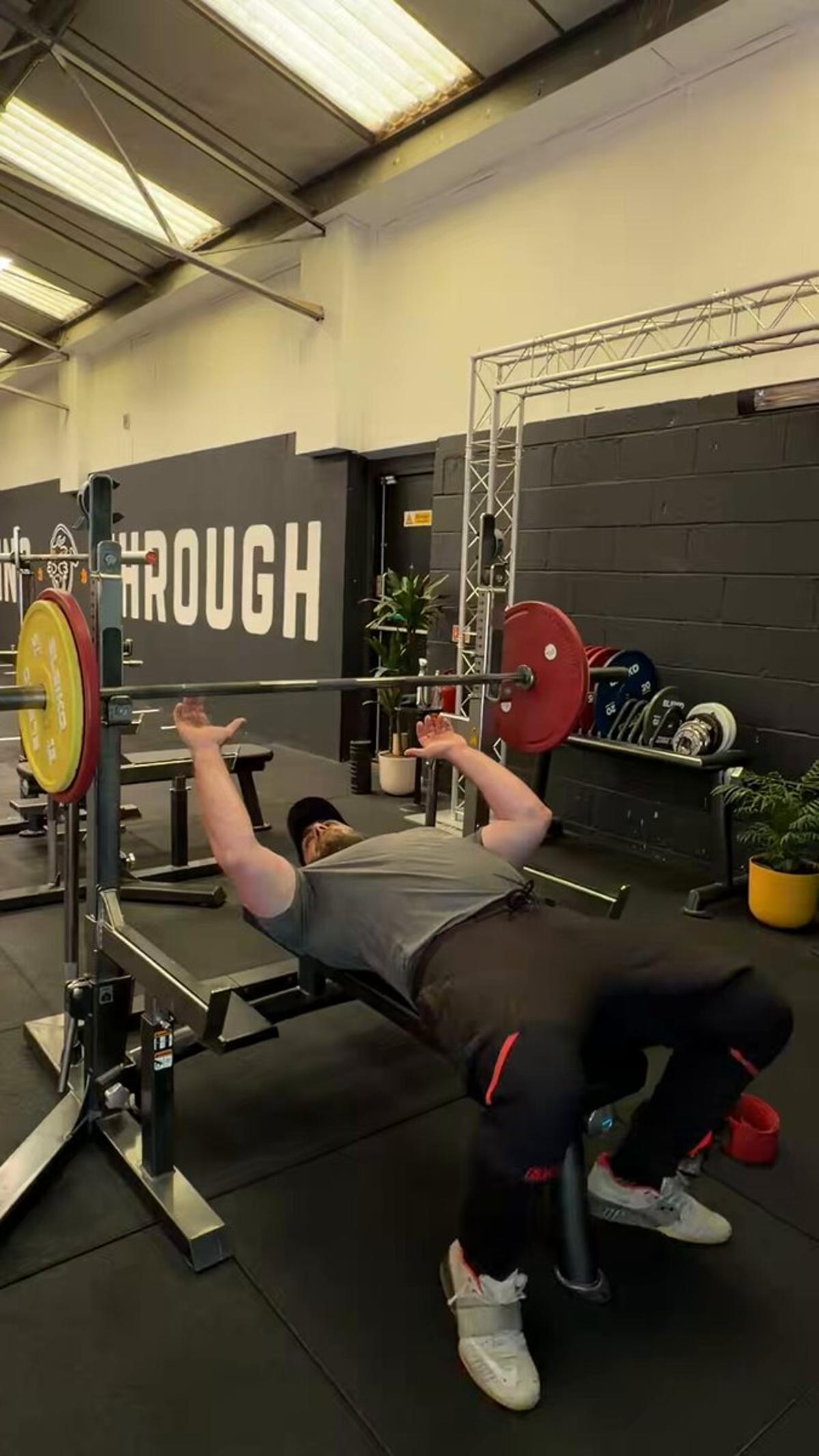 Cautious Bench Press Progression After Labrum Tear