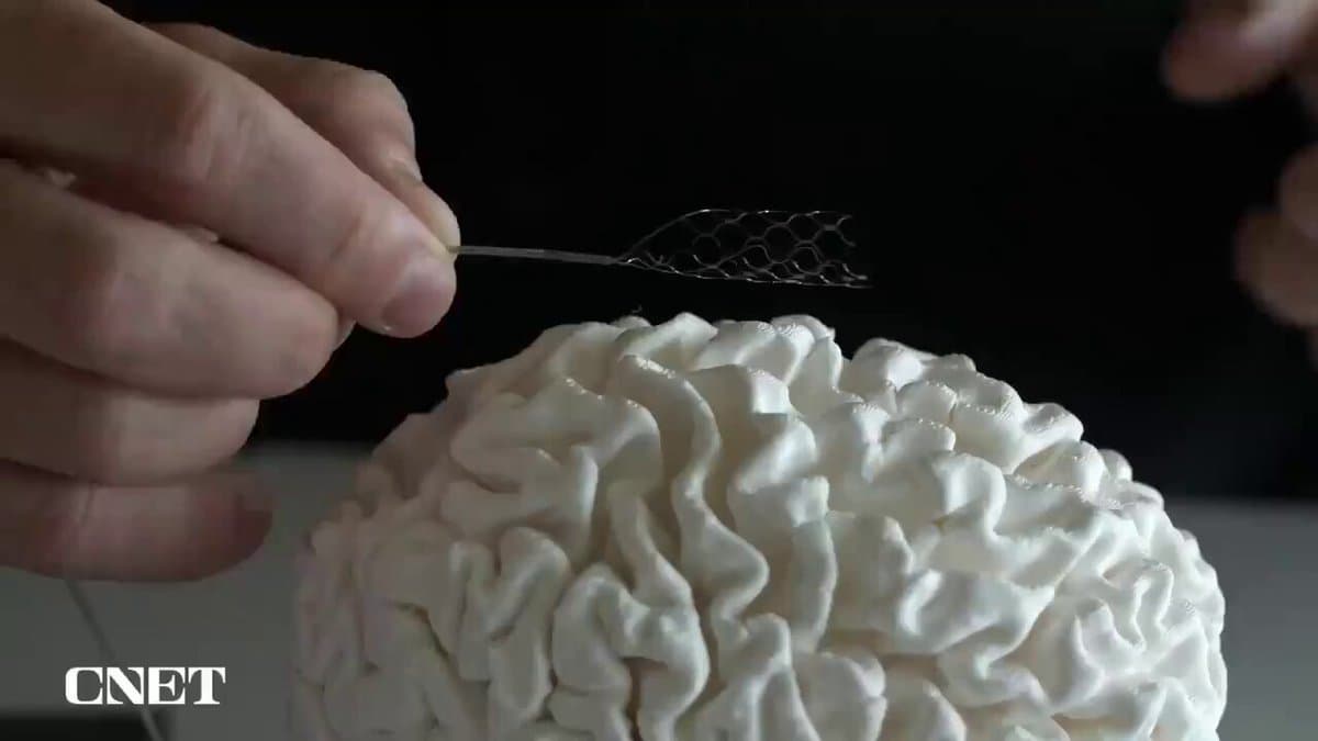 ChatGPT Drives Next‑gen Brain‑computer Interface Breakthroughs
