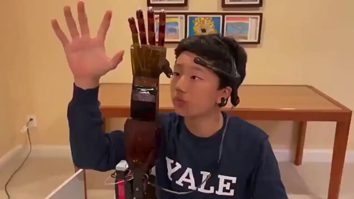 Teen Creates AI‑driven Mind‑controlled Prosthetic Arm