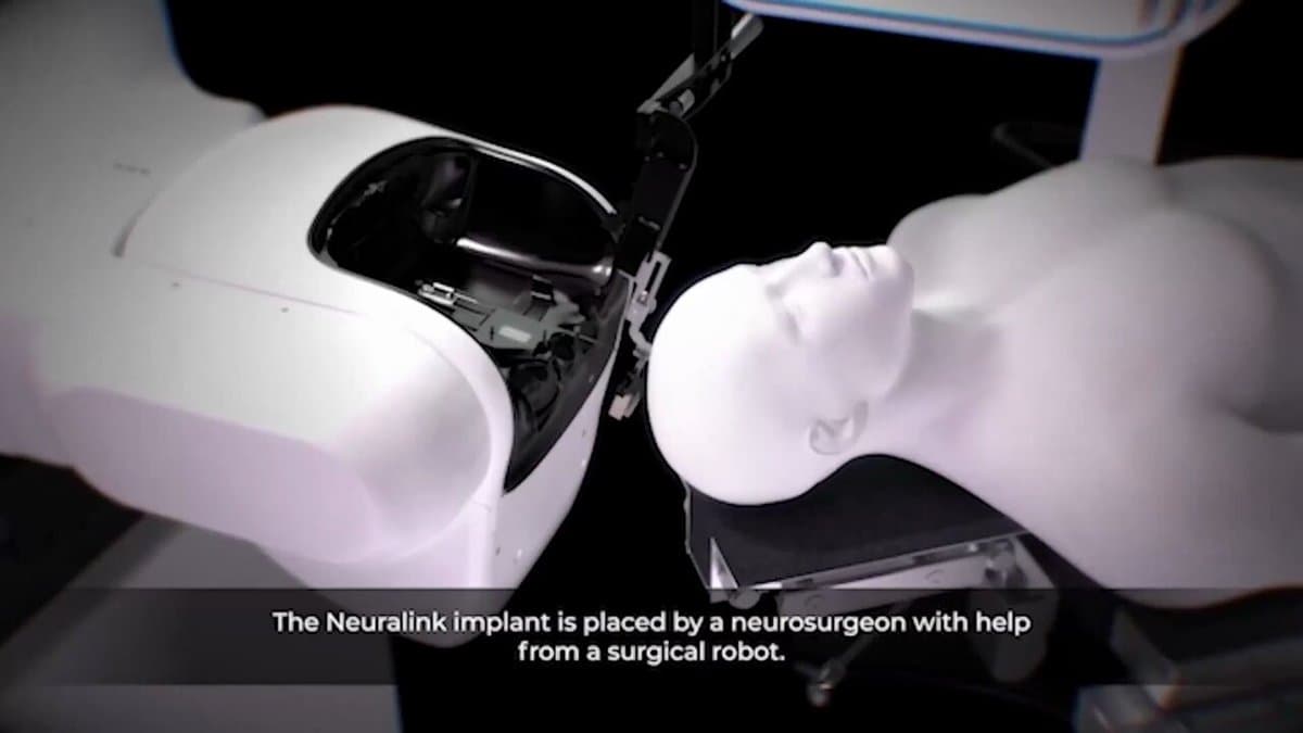 Neuralink's Robot Advances Thought-Controlled Computing