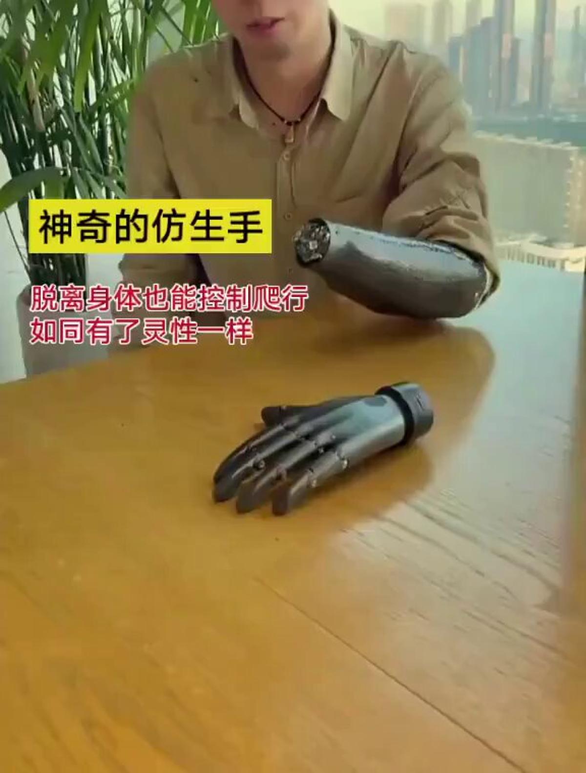 Wireless EMG Bionic Hand Achieves Independent Finger Control
