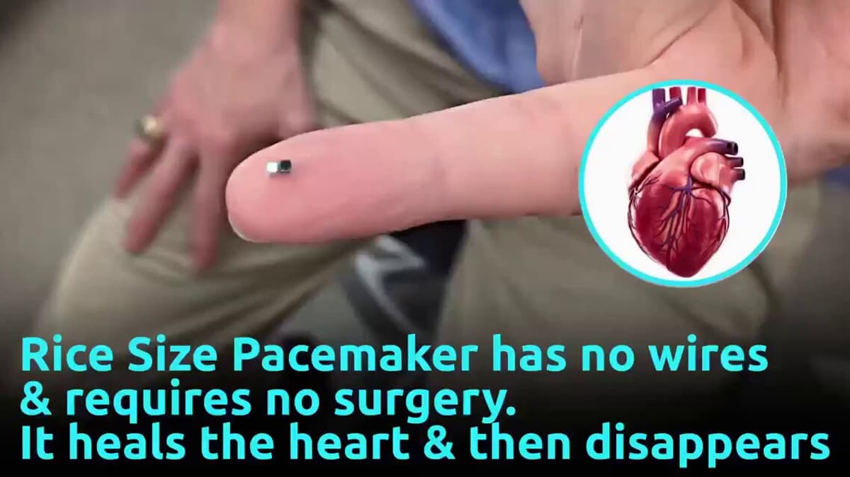 Miniature Pacemaker Revolutionizes Cardiac Care