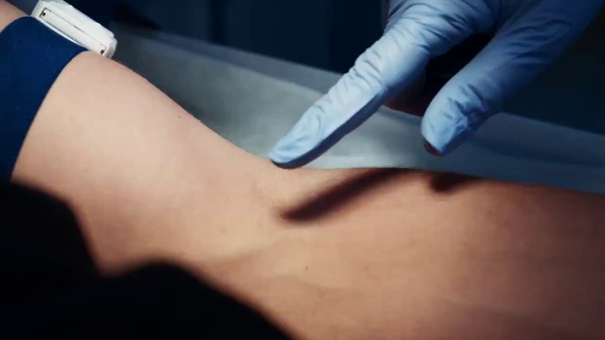 Autonomous Robot Achieves Zero‑Error Blood Draws