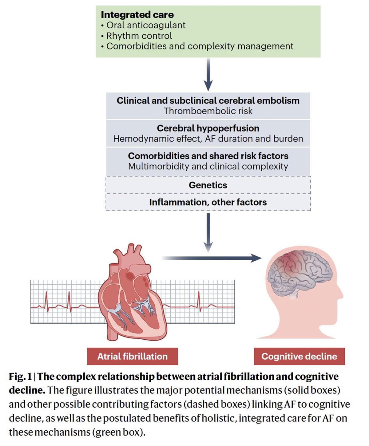 Atrial Fibrillation Drives Cognitive Decline, Not Prevented by Blood Thinners