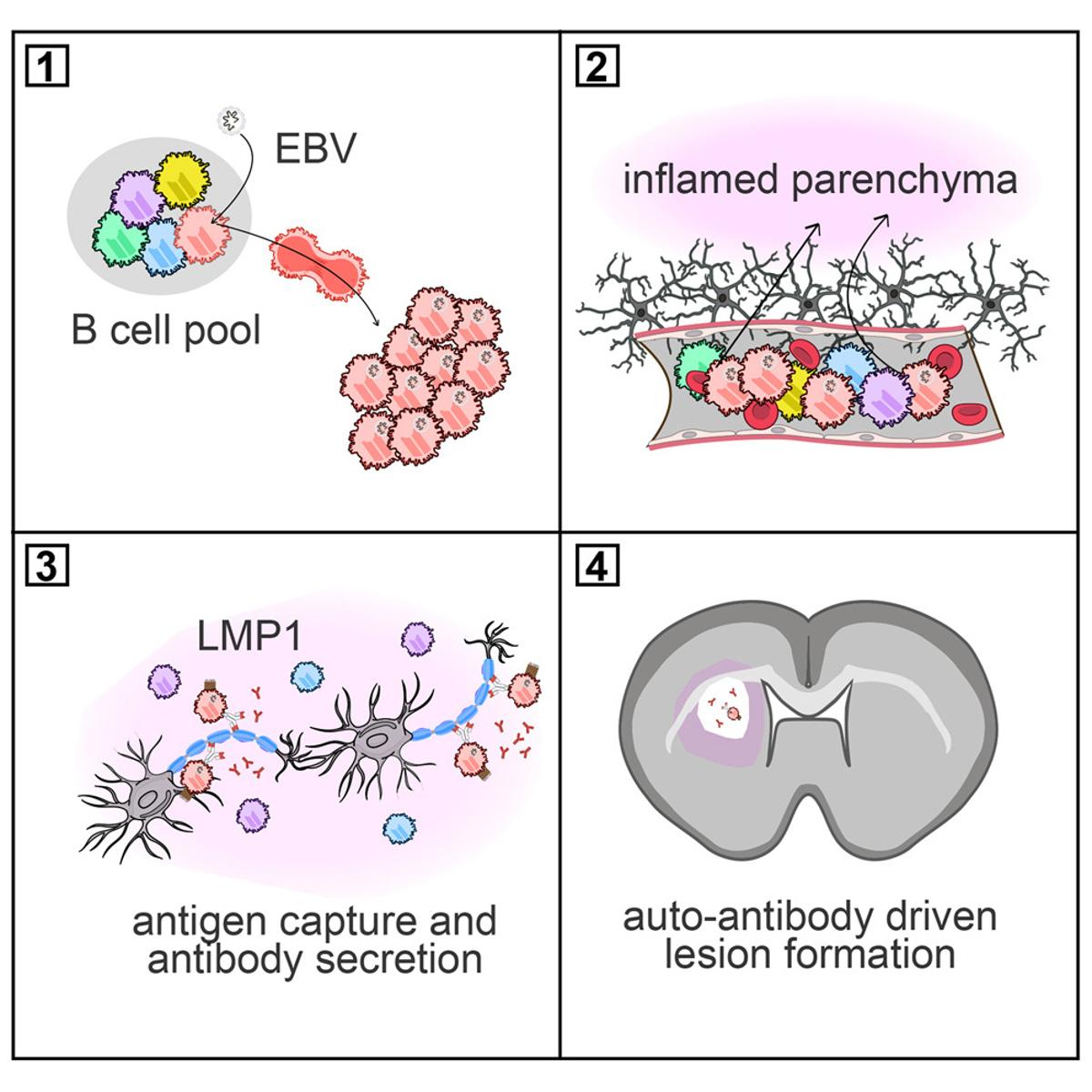 New Cell Studies Link EBV to Multiple Sclerosis Mechanisms