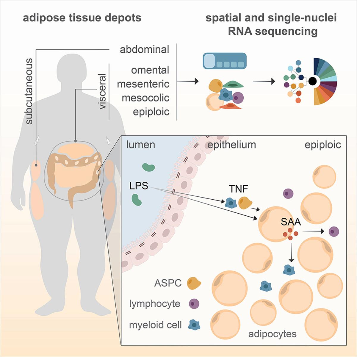 Epiploic Fat Fuels Inflammation in Severe Obesity