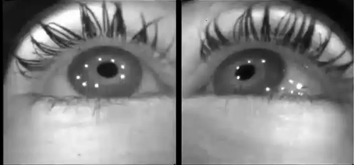 Indoor Eye Use May Drive Myopia, New Study Finds