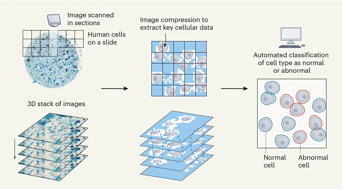 AI Automates Cytology, Streamlining Cell Pre‑Screening