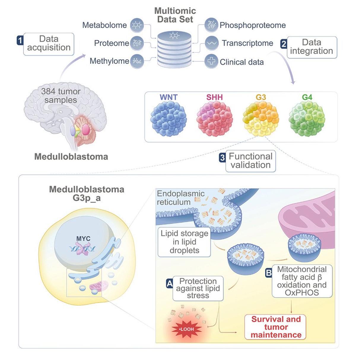 Group 3 Medulloblastoma Shows Diverse Lipid Dependencies