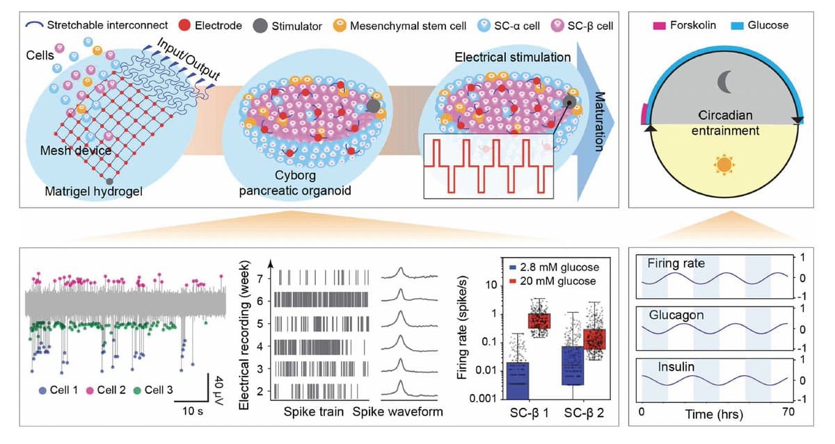 Cyborg Islet-Cell Implant Boosts Precision Diabetes Therapy