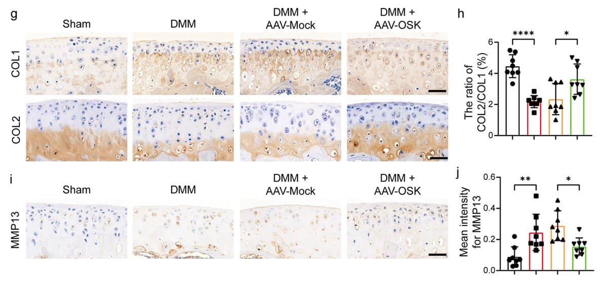 OSK Gene Combo Reverses Joint Damage via Epigenetics