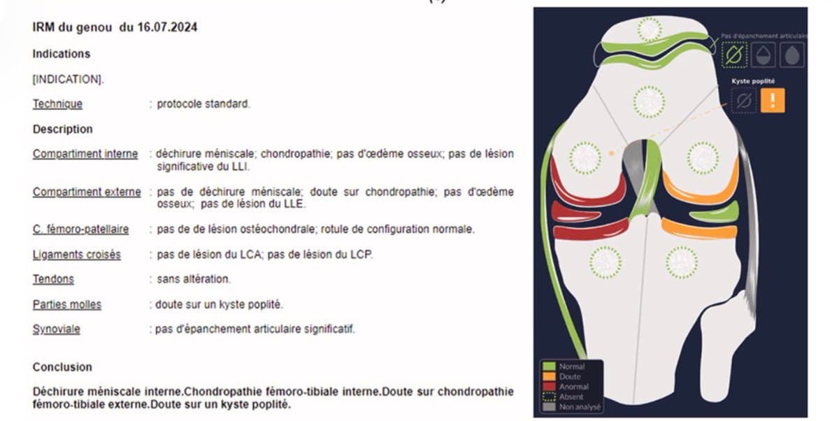 AI Integration Speeds Knee MRI Reporting by 13.4%