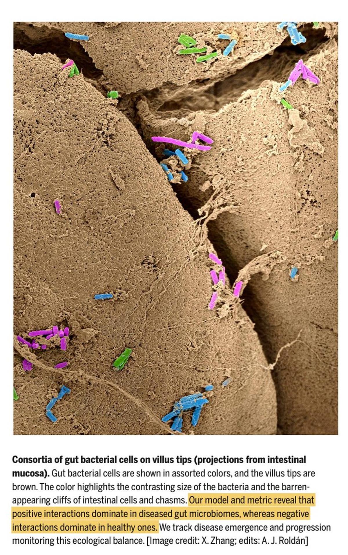 Gut Bacteria Interactions Dictate Health and Disease Risk