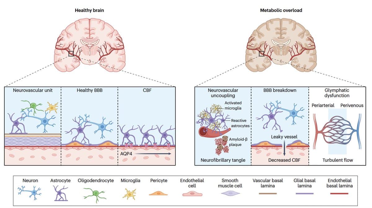 Obesity Accelerates Neurodegeneration, New NatMetabolism Study Shows