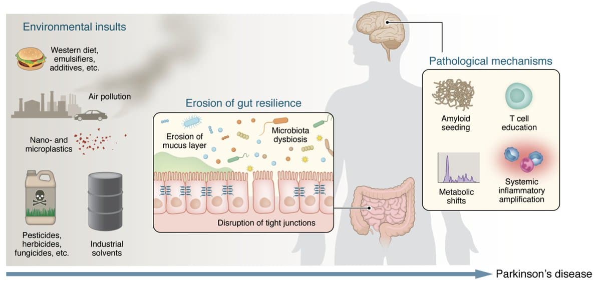 Gut Health and Toxins Drive Parkinson’s Disease Surge