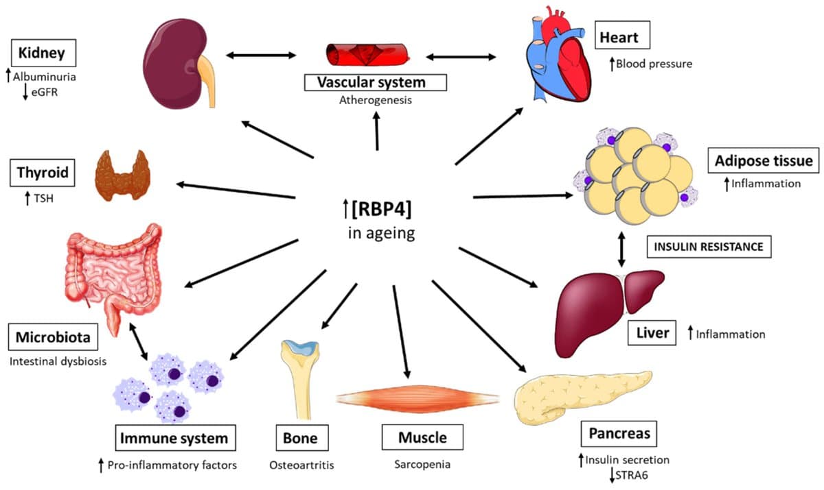 Rising RBP4 Drives Inflammation and Age‑Related Disease