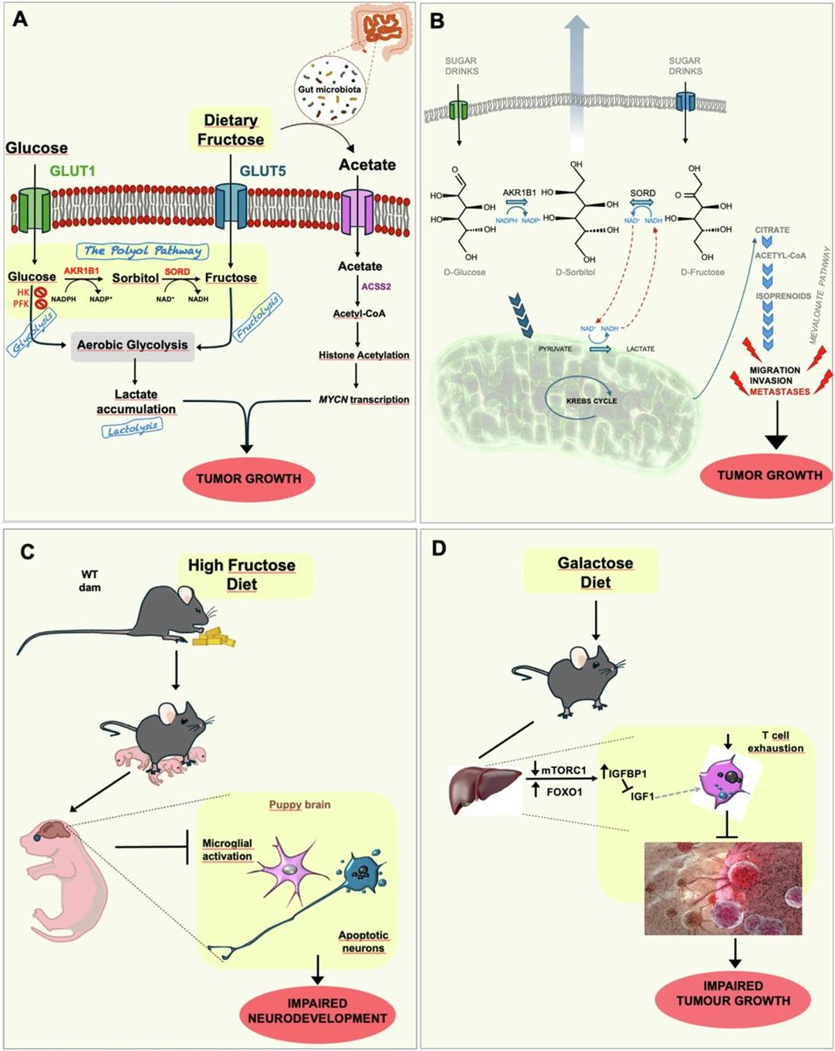 Fructose Metabolism Fuels Brain Tumor Growth, Study Shows