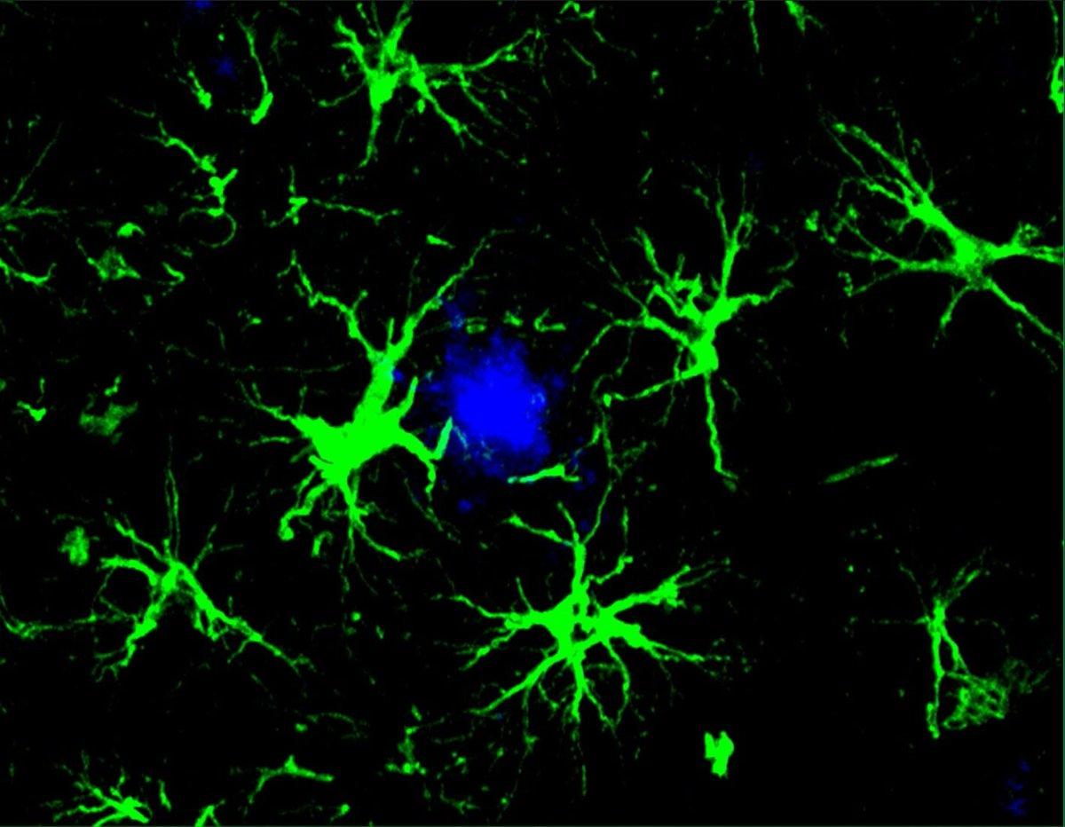 Engineered Brain Cells Erase Alzheimer’s Proteins in Mice
