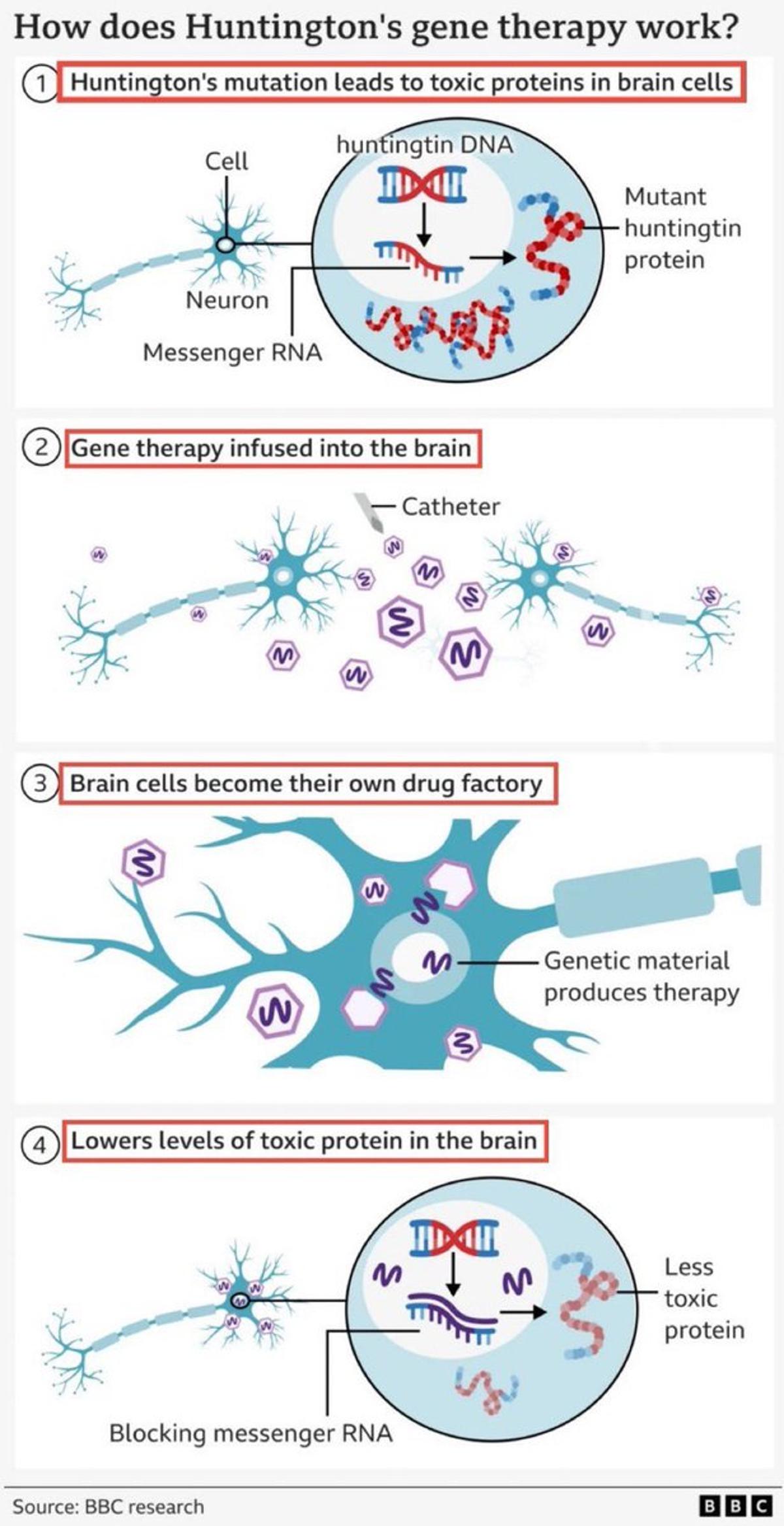 BBC Infographic Explains UniQure Gene Therapy for Huntington