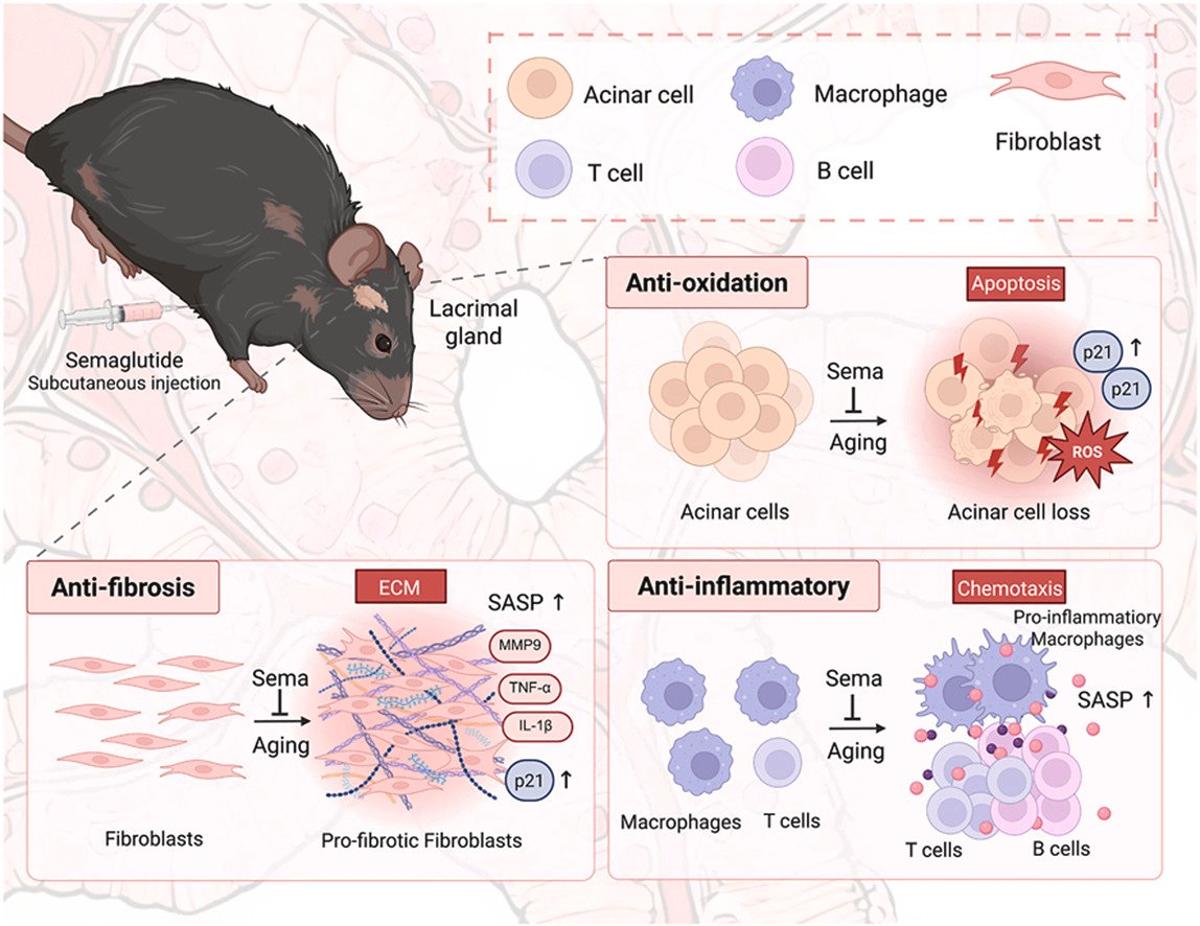 Semaglutide Restores Lacrimal Gland, Relieves Age‑Related Dry Eye