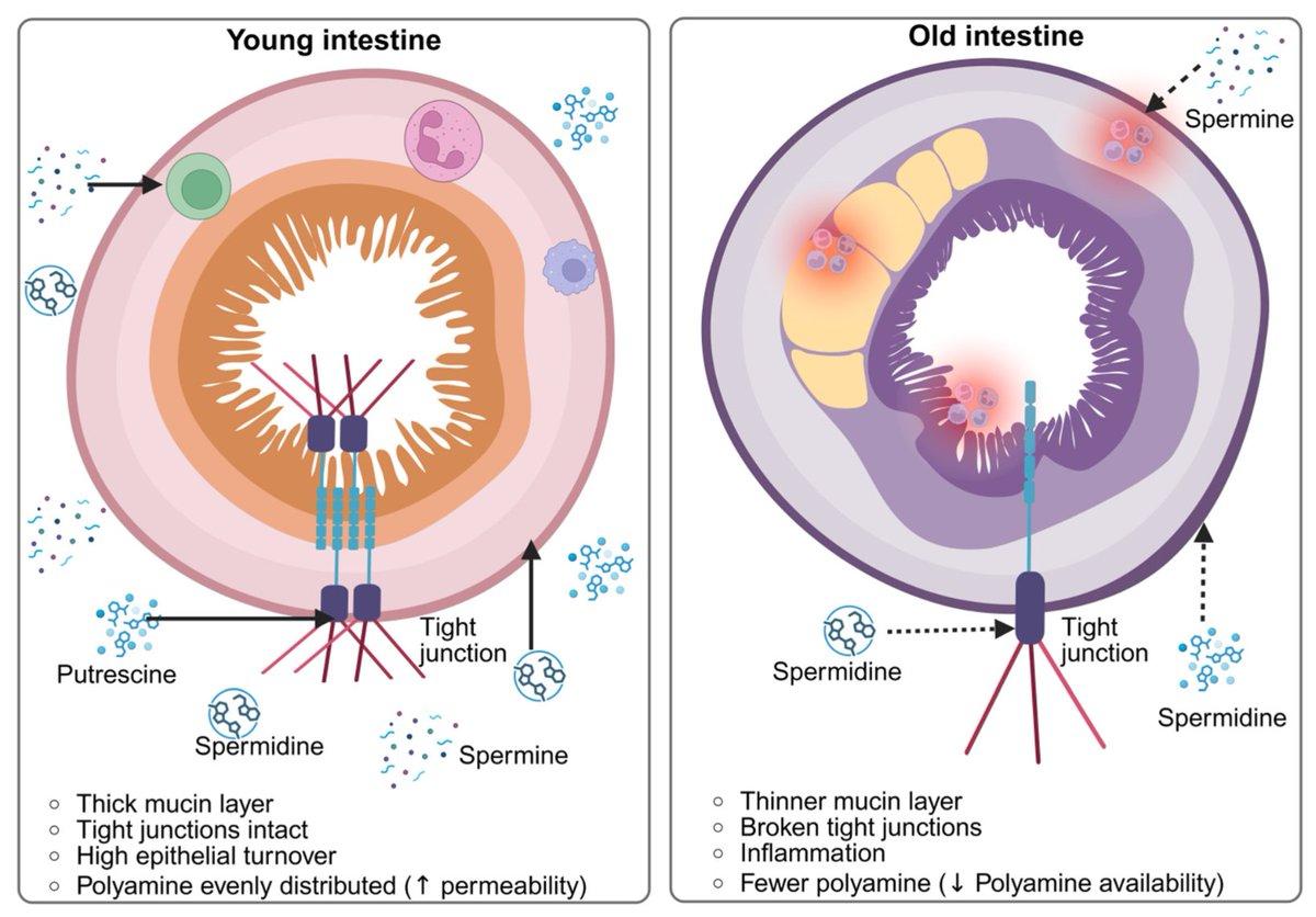 Diet‑Microbiota‑Polyamine Axis Drives Intestinal Aging