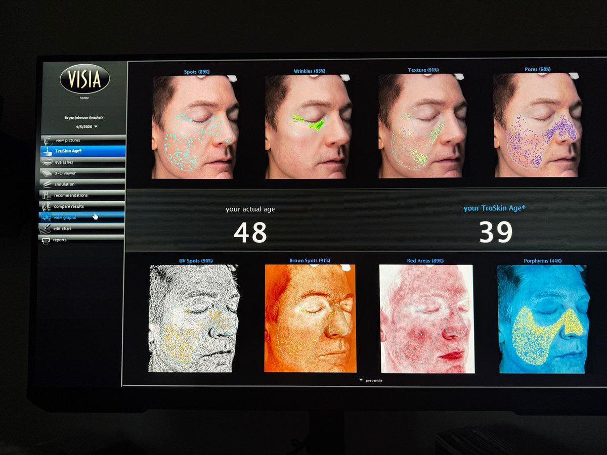 Nine-Year Skin Age Reversal Using Multi‑Depth Therapy