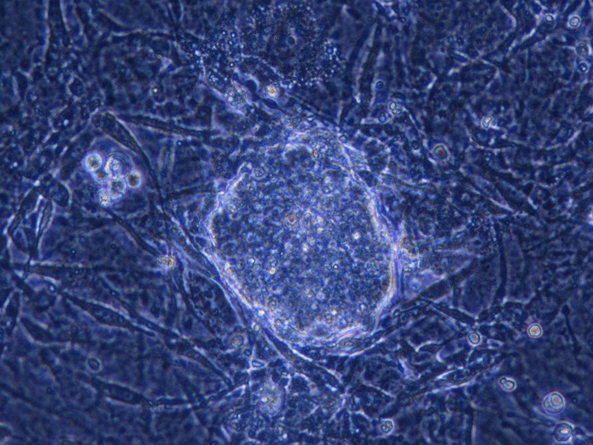 20 Years of iPSC Research: From Discovery to Applications