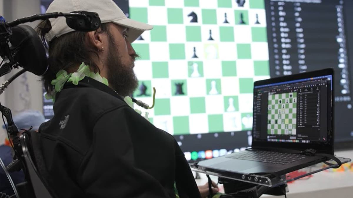 Neuralink Threatens Agency, Turns Minds Into Marketable Data