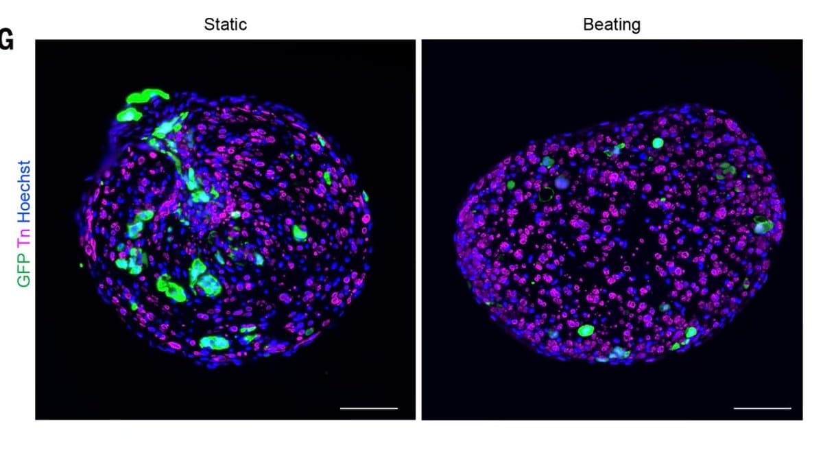 Nesprin‑2 Protein Blocks Heart Cancer, May Aid Other Tumors