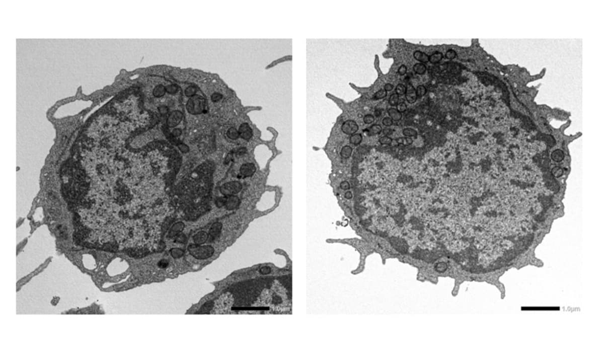 Cellular Stress Drives Stem Cell Aging, Revealing Therapy Targets