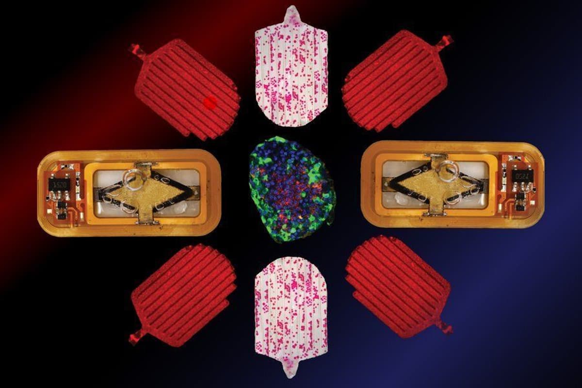 Implantable Islet Cells May Eliminate Insulin Injections