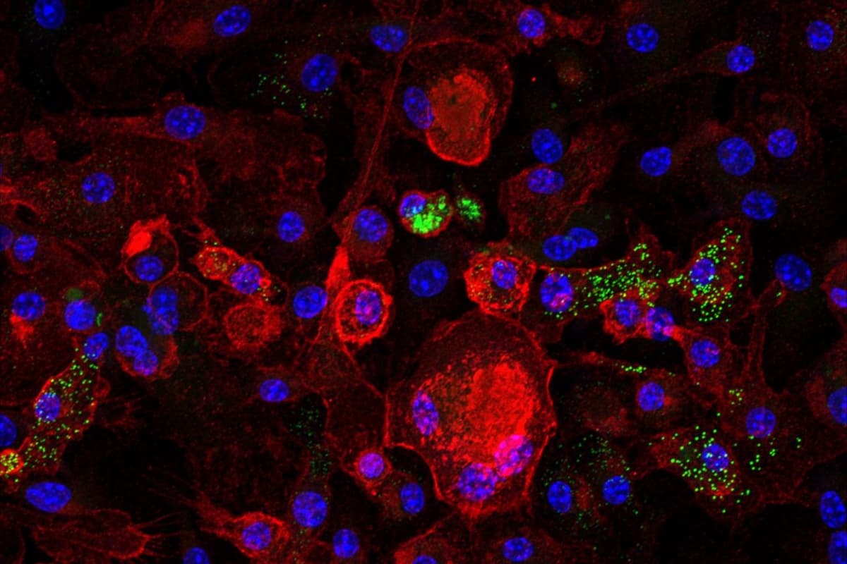 Zombie Immune Cells Linked to Fatty Liver, Inflammation, Aging