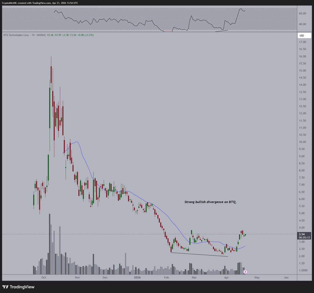 Quantum Leap Threatens Bitcoin, Urges 2029 Crypto Upgrade