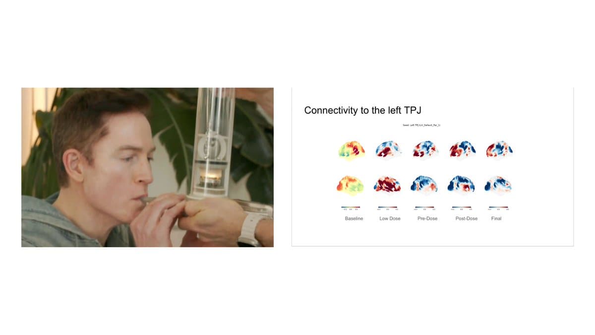 5‑MeO‑DMT Reveals Self‑Other Illusion in Brain