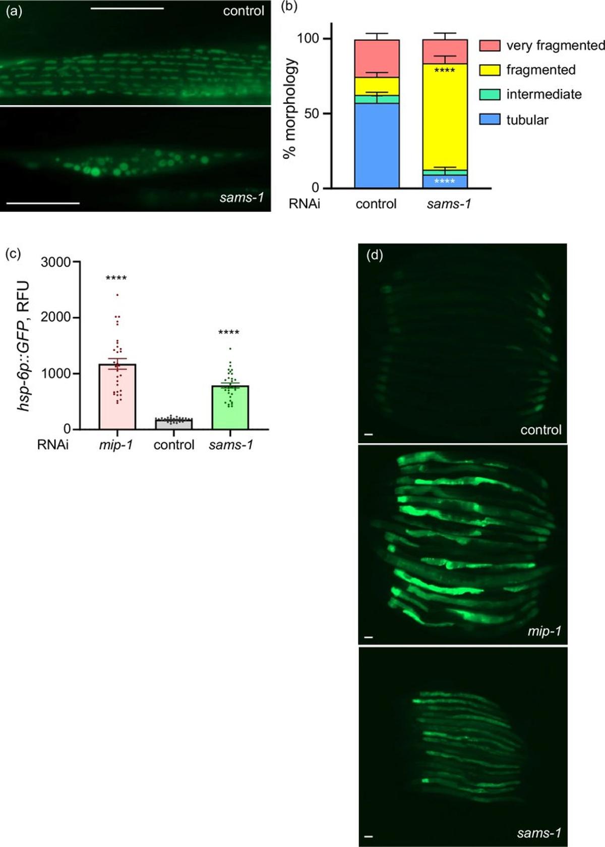 Diet Can Reverse Phosphatidylcholine‑driven Mitochondrial Aging