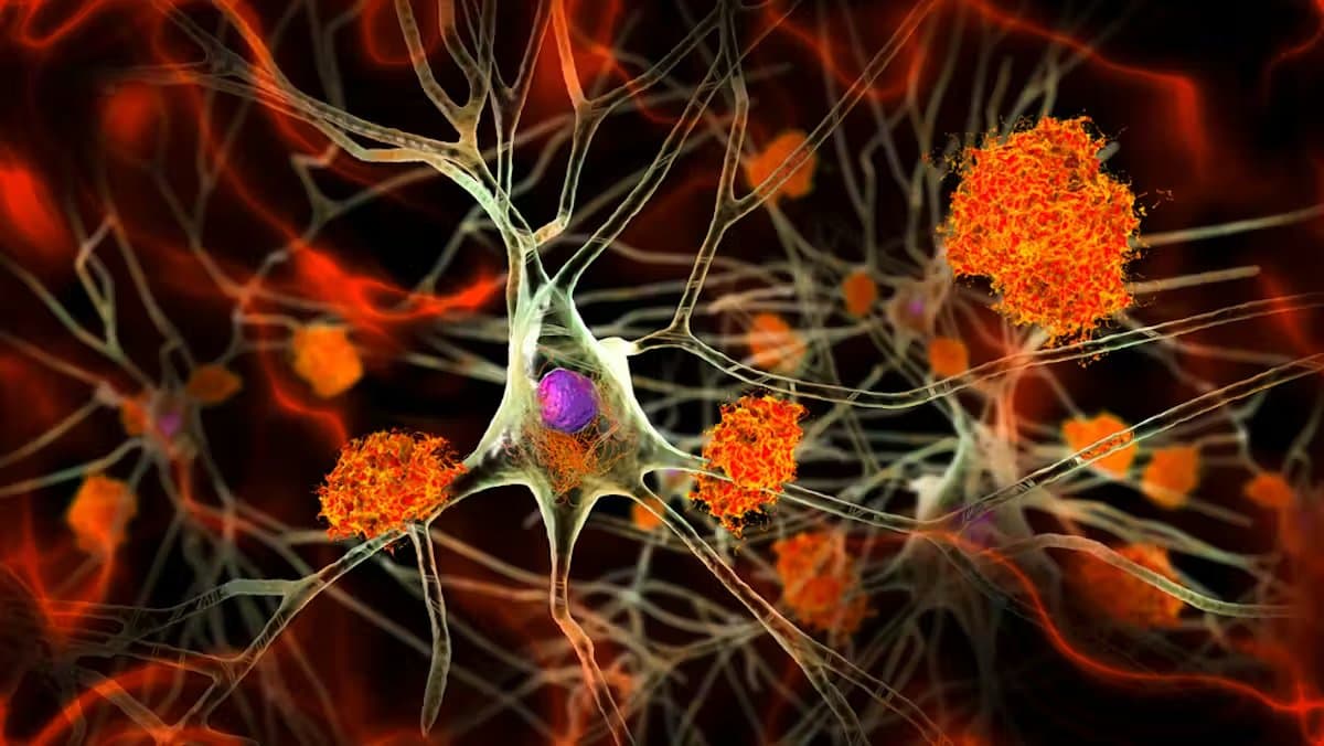 Alzheimer's Drugs Show Minimal Benefit, Review Reveals Deeper Issues