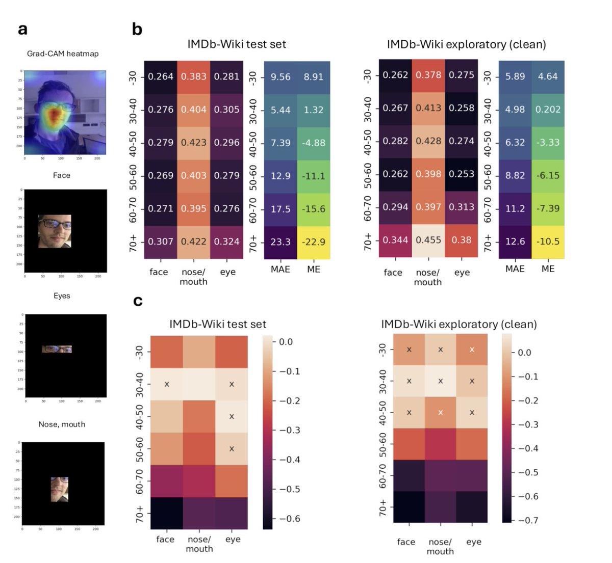 Facial Age Acceleration Predicts Earlier Death, Varies by Job