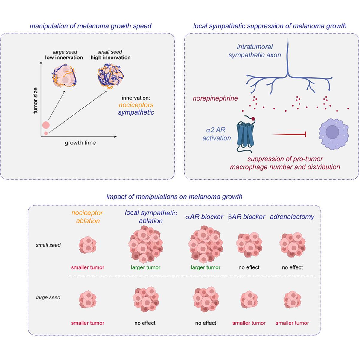 Skin Nerve Fibers Slow Melanoma Growth, Challenging Cancer Neuroscience